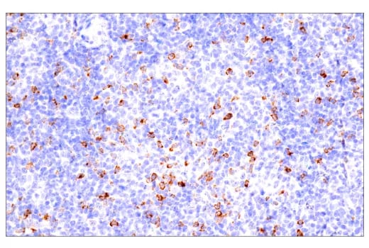 CTLA-4を使用しLeica BONDで行ったB細胞非ホジキンリンパ腫のIHC解析。