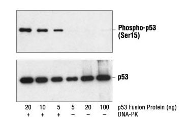 p53融合タンパク質のウェスタンブロット解析