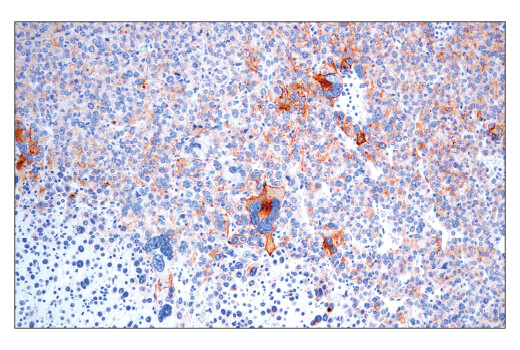 CD4 (D7D2Z) Rabbit mAb #を用いた様々なパラフィン包埋Renca同系マウス腫瘍モデルの免疫組織化学染色。