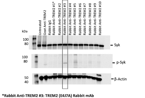 SfN 2022レポート_TREM2リコンビナントモノクローナル抗体ライブラリー
