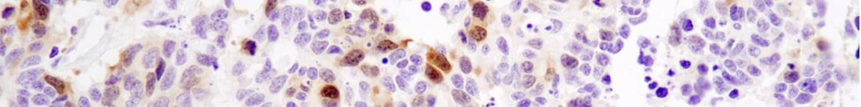 CSTブログ: Lab Expectations免疫組織化学染色を成功させる4つのステップ:ステップ1 - 抗原賦活免疫組織化学染色を成功させる4つのステップ:ステップ1 - 抗原賦活