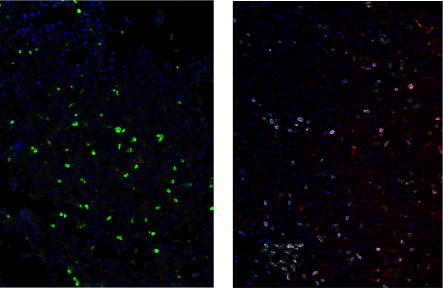 マウス膠芽細胞腫腫瘍組織のマルチプレックスIHC解析