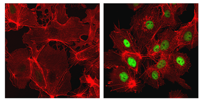 CST抗体：HIF-1α (D1S7W) XP® Rabbit mAb