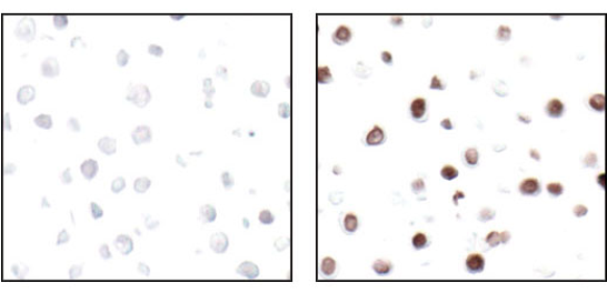 未処理あるいはUV処理したパラフィン包埋HT-29細胞をPhospho-Histone H2A.Xを用いて免疫組織化学染色で解析しました