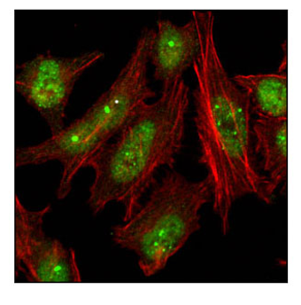 HeLa細胞を53BP1 Antibodyを用いて免疫蛍光染色し、53BP1共焦点顕微鏡で観察しました。