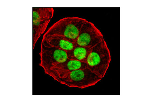 HT-29細胞のの共焦点免疫蛍光染色による解析