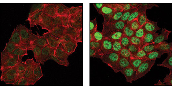 MCF-7細胞の共焦点免疫蛍光染色による解析