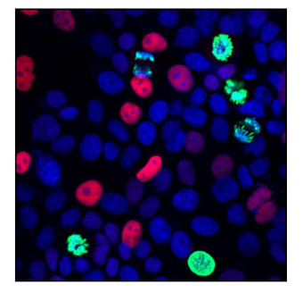 MCF7細胞の共焦点免疫蛍光染色による解析