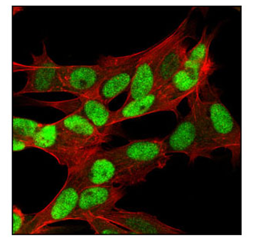 SH-SY5Y細胞の共焦点免疫蛍光染色画像