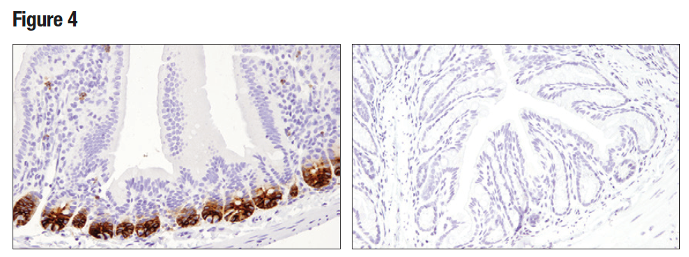 パラフィン包埋した正常マウスの小腸 (左) および結腸 (右) を、Olfm4 (D6Y5A) を用いて免疫組織化学染色で解析しました。