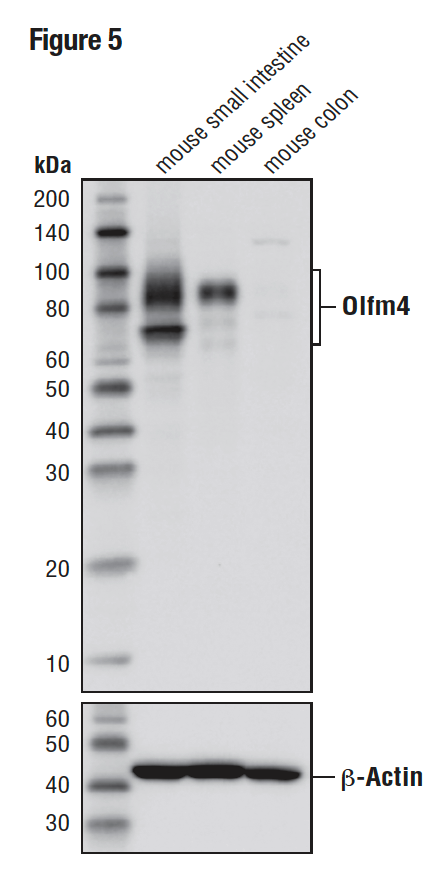 マウス小腸 (ポジティブ)、マウス脾臓 (ポジティブ)、およびマウス結腸 (ネガティブ) からの抽出物を、Olfm4 (D6Y5A) (上) を用いてウェスタンブロッティングで解析しました。