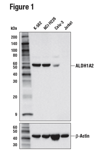 様々な細胞株の細胞抽出物をALDH1A2 (E6O6Q) を用いたWBで解析しました。