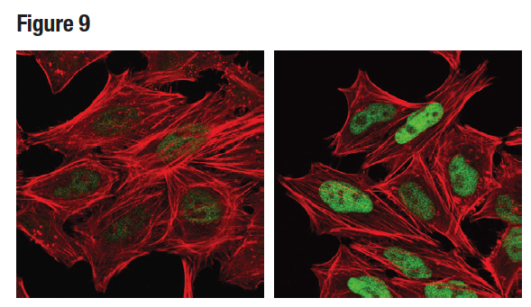 Phospho-c-Jun (Ser73) (D47G9) (緑) を用いたHeLa細胞の共焦点ICC解析