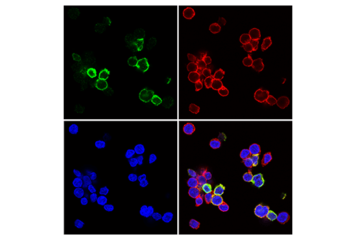 純化したヒトT細胞におけるCD8 (赤色) とTIGIT (緑色) の共発現