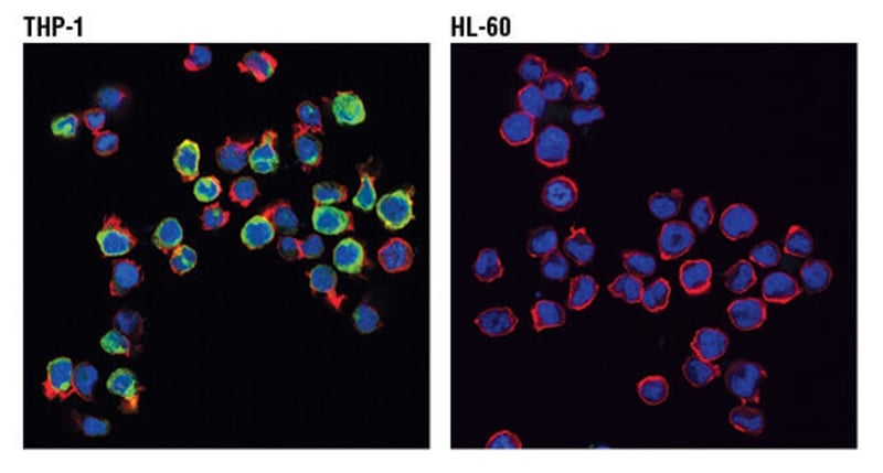  THP-1とHL-60の免疫蛍光染色による解析