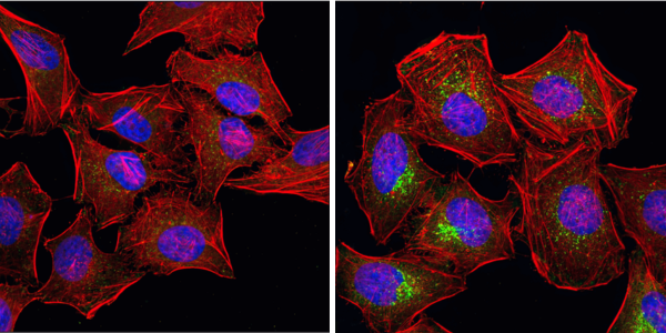 オートファジーRapamycin phospho mTOR