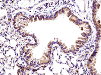 パラフィン包埋マウス肺組織を、リコンビナントモノクローナル抗体Bax (D3R2M) Rabbit mAb #14796を用いて免疫組織化学染色して解析しました。