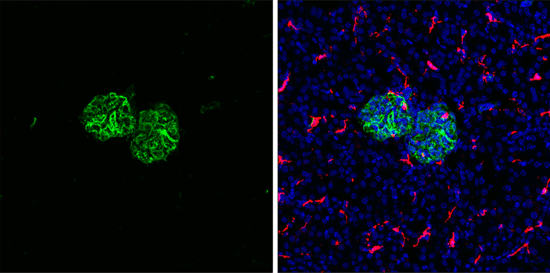 Vimentin Antibodyを用いたマウス腎臓のIF解析