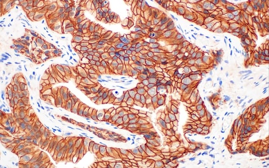 8480_IHC analysis beta catenin antibody EMT signaling