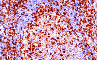 48274_CD4抗体を使った細胞障害性T細胞のIHC解析