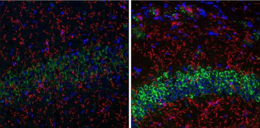 Hippocampus_Amyloid-beta precursor protein (APP) monoclonal antibody _alzheimers disease biomarker_small