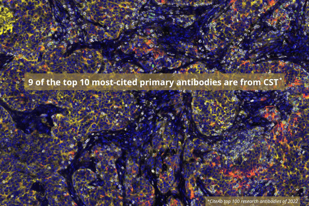 最も引用された研究用抗体10のつい9つは、CSTの抗体