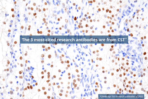 最も引用された研究用抗体3抗体は、CSTの抗体