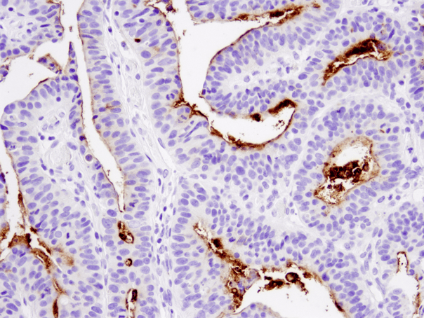 ウェビナー - がん幹細胞マーカーCD133を標的とするグリコシル化非依存性抗体の検証